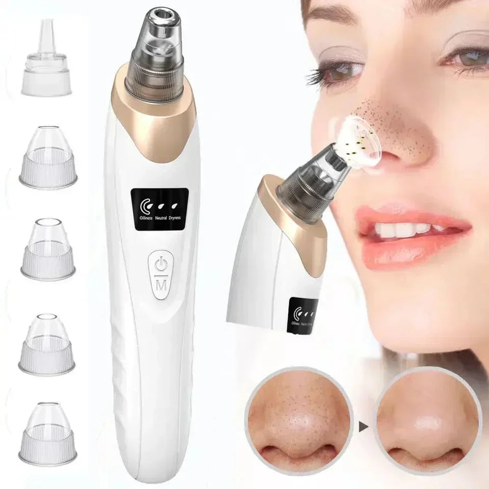 5-in-1 Blackhead Remover (Acne Cleaner)