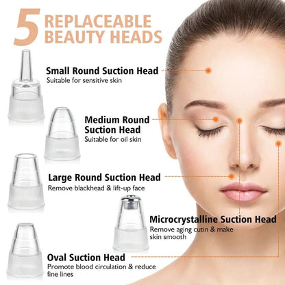 5-in-1 Blackhead Remover (Acne Cleaner)